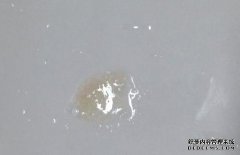 当您早上醒来时，您的喉咙可能会变黄，血液可